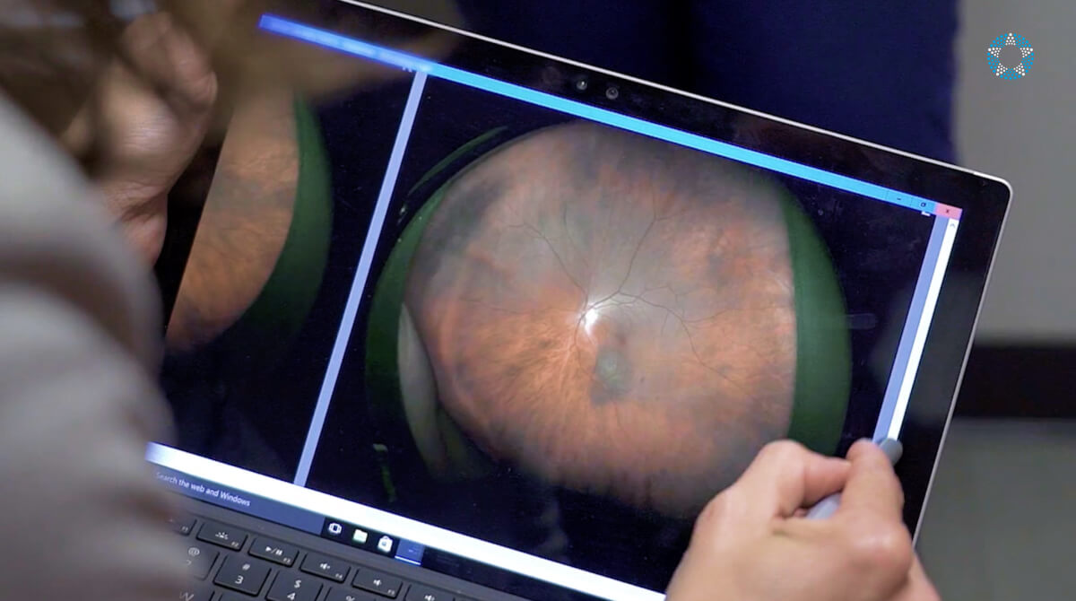 Leading the Fight Against Uveal Melanoma